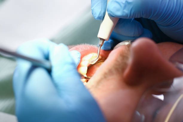 Best Urgent Care for Lost Fillings or Crowns in Mford, IL