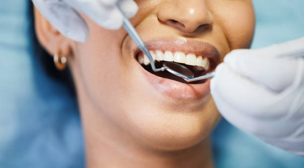 Best Emergency Wisdom Teeth Removal in Mford, IL
