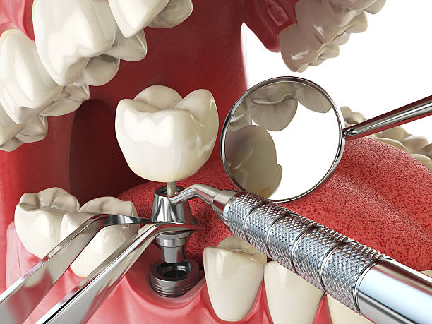 Best Weekend Emergency Dentist in Mford, IL