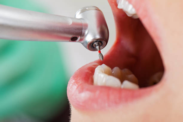 Best Emergency Gum Treatment in Mford, IL